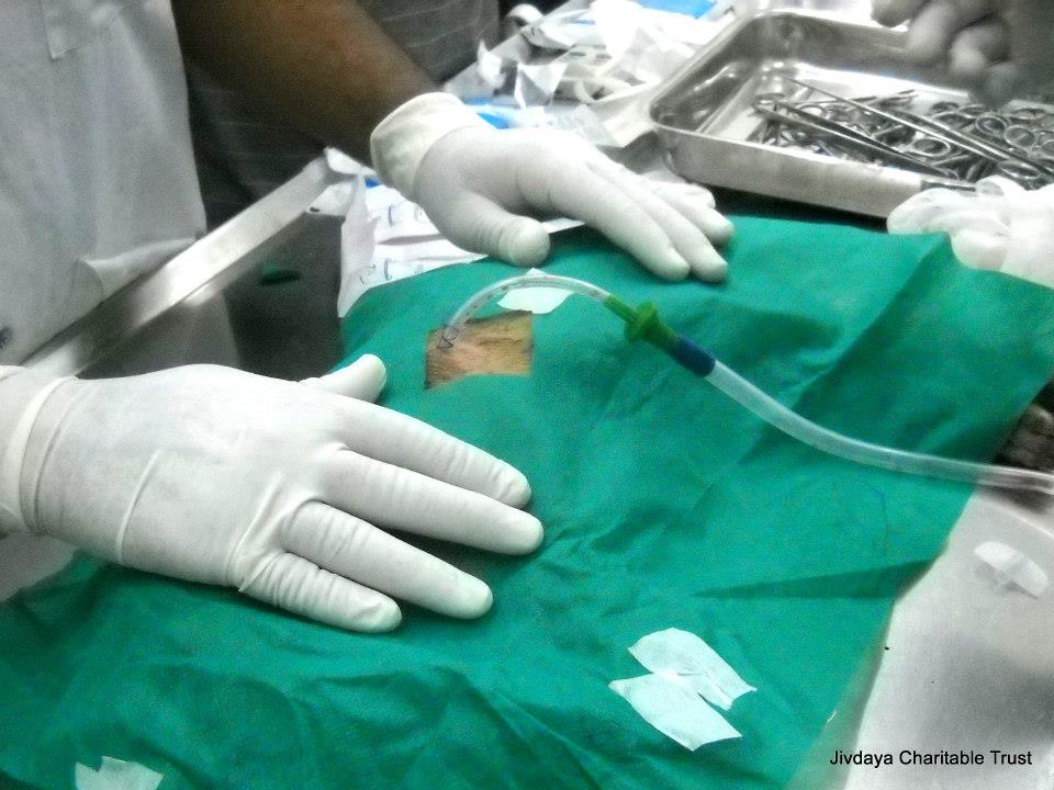 The chest tube is a hollow, flexible tube in the chest. It acts like a drain. They used a water-based drain for this particular operation.